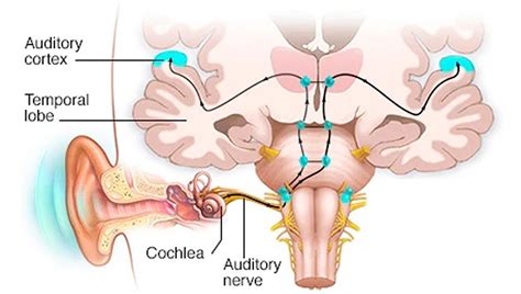 Auditory cortex, auditory area of brain location & function