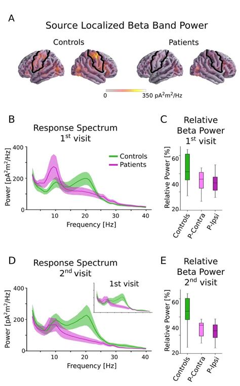 Beta power in controls and patients. A. Source localized beta band... | Download Scientific Diagram