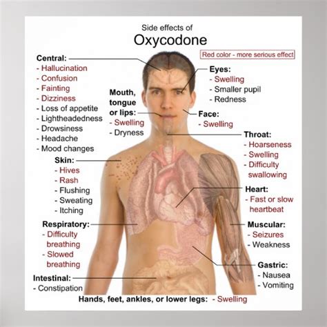 Chart of the Main Side Effects of Oxycodone Poster | Zazzle