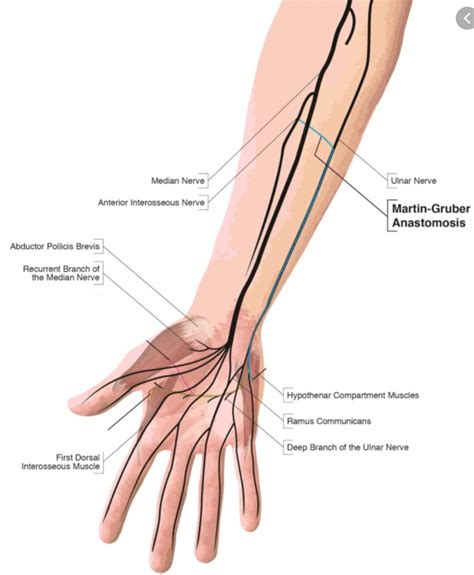 AIN Compressive Neuropathy - Hand - Orthobullets