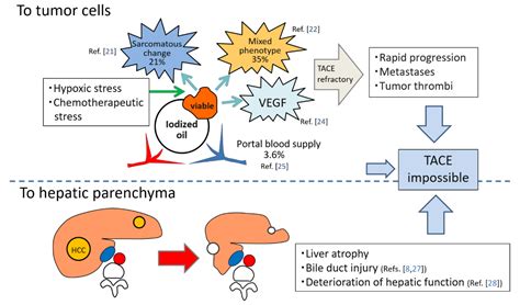 Applied Sciences | Free Full-Text | Treatment Strategy of Transarterial Chemoembolization for ...