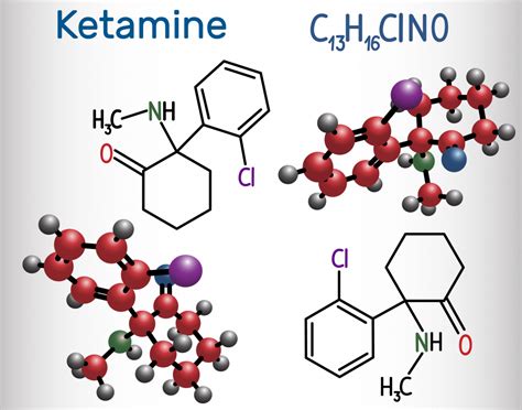 Ketamine Therapy: Which treatment is right for you? - Cannadelics