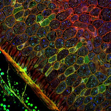 Confocal microscopy of plant tissues | (Microscope slide fro… | Flickr