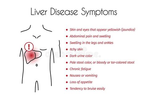 Symptoms of Liver Disease stock vector. Illustration of gallbladder ...