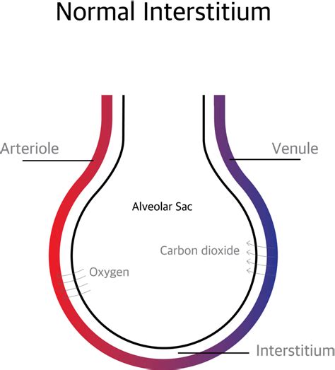 Pulmonary Interstitium and Interstitial lung disease | Holistic Doctor Online