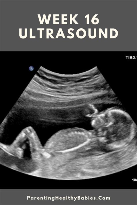 Ultrasound clinic – Artofit