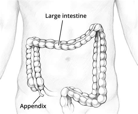 Definition & Facts for Appendicitis - NIDDK