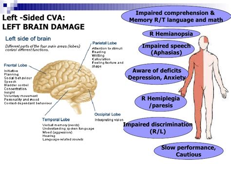 Left Hemisphere Stroke - Milka Clarke Stroke Brain Trauma Foundation