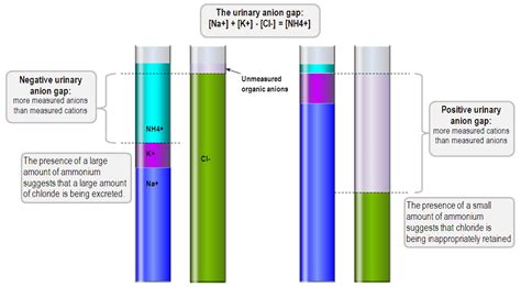 The urinary anion gap in normal anion gap metabolic acidosis | Deranged Physiology