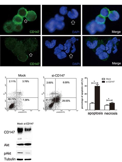 Acquisition of anoikis resistance through CD147 upregulation: A new mechanism underlying ...