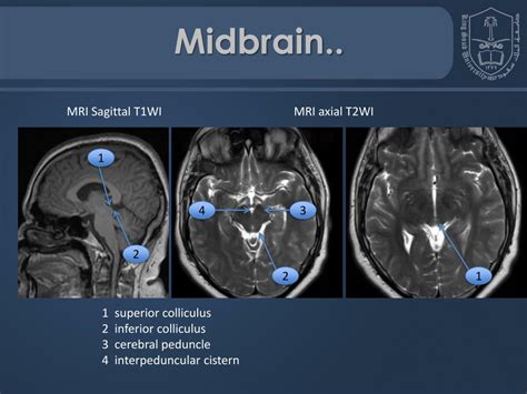 PPT - Lecturer name: Dr. fahad albadr Radiology chiarman Lecture Date: 20-9-2011 PowerPoint ...