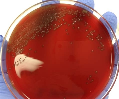 Streptococcus pneumoniae | Microbiology, Streptococcus pneumoniae, Med lab