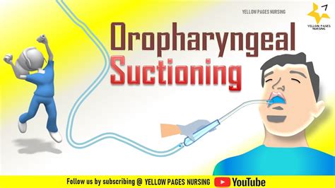 Oropharyngeal suction I Oral suctioning for adults I Procedure I ...