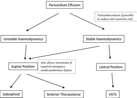 Pericardial Drain Management - Best Drain Photos Primagem.Org
