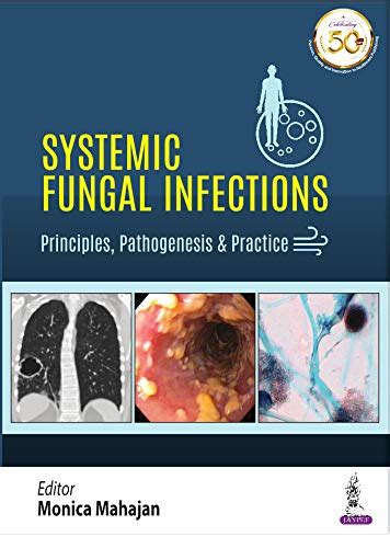 Systemic Fungal Infections eBook : Mahajan, Monika: Amazon.in: Kindle Store