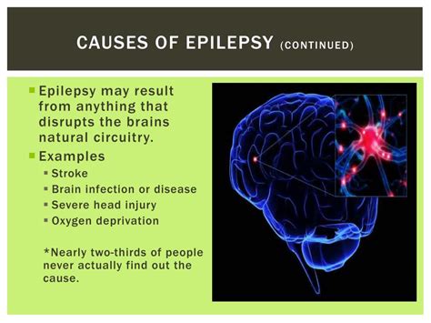 PPT - Epilepsy PowerPoint Presentation, free download - ID:2841428