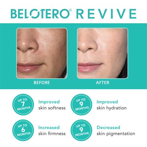 Belotero® Revive : The Only Hyaluronic Acid Skin Booster With Glycerol - Premier Clinic