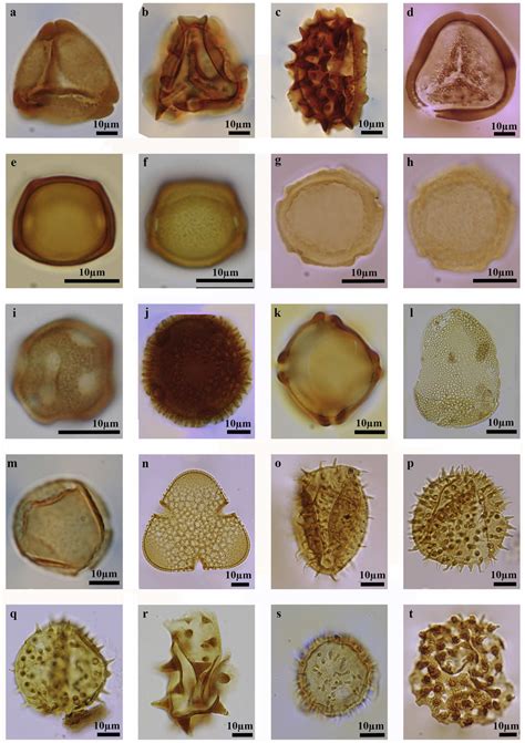 Identification of pollen at the family level (Genus names are provided... | Download Scientific ...