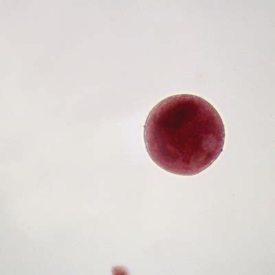 Balantidium coli Cysts Slide, smear | Carolina.com