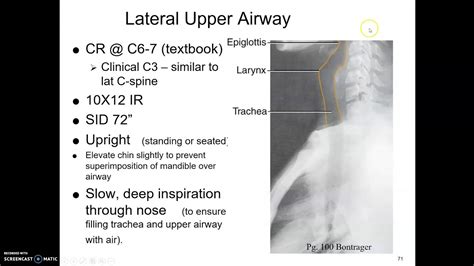 Soft Tissue Neck - YouTube