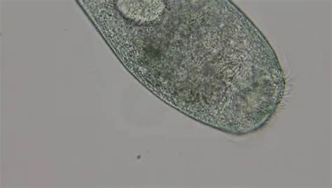 Stentor: Structure, Classification, and Characteristics – Microscope Clarity