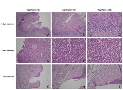 Histological analysis of neutrophils, macrophages, lymphocytes, and ...