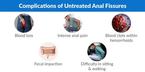 Which Doctor Should I Consult for Anal Fissure Treatment? - Piles Doctor