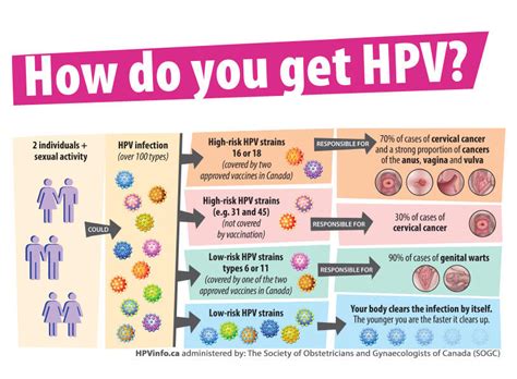 HPV - Sona Oconnor