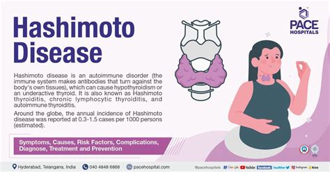 Hashimoto's thyroiditis | Hashimoto’s disease – Symptoms & Causes