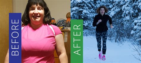 Success Stories | Sleeve Gastrectomy | Anchorage Bariatrics