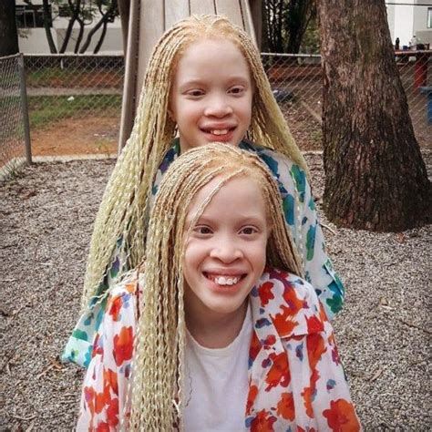 Lara & Mara Bawar Twins Albino Model, Albinism, Dark Complexion, Lara ...