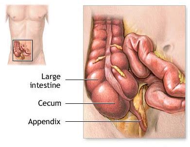 Appendix Location, Function, Pain, Symptoms, cancer & burst appendix