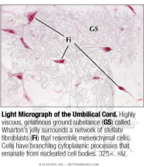 Light Micrograph of the Umbilical Cord