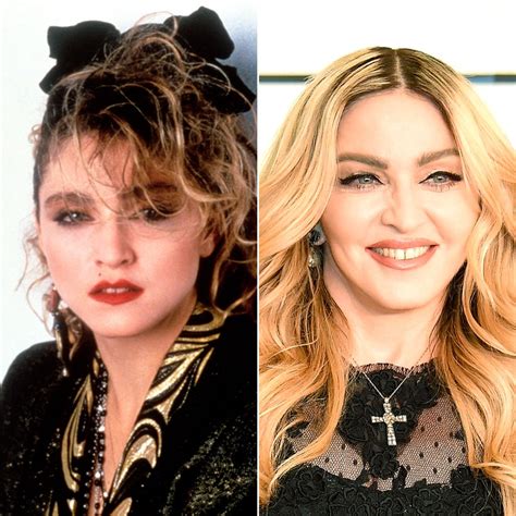 Madonna: How Her Face Has Changed | Us Weekly