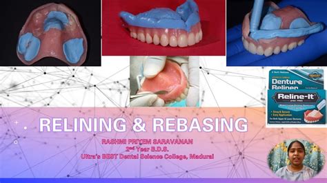 Relining and Rebasing of Dentures | Complete and Partial Denture ...