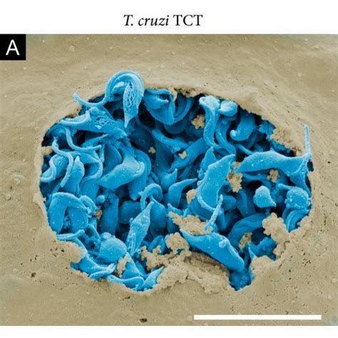 Timeline showing important historical achievements in microscope ...