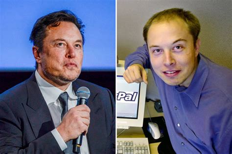 Elon Musk may have spent $140k on plastic surgery including fat injections & four hair ...