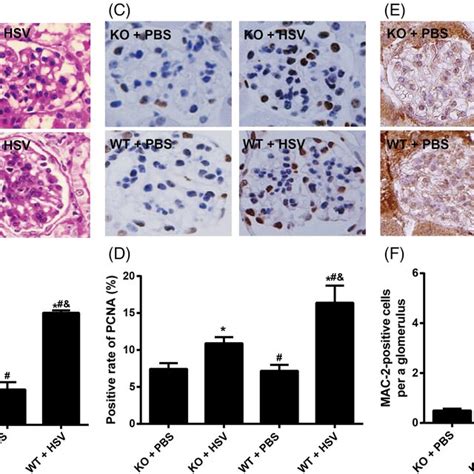 Effect of SOCS‐3 knockout on the renal function of HSV‐induced MsPGN... | Download Scientific ...