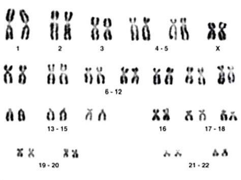 What Chromosomes Belong to a Typical Human Male