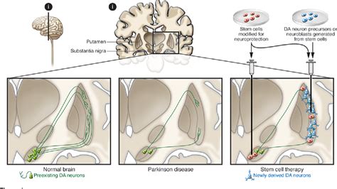 Figure 1 from Stem cells in human neurodegenerative disorders--time for ...