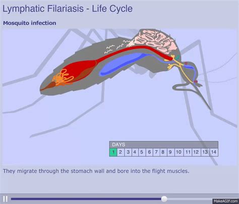 Elephantiasis Life Cycle