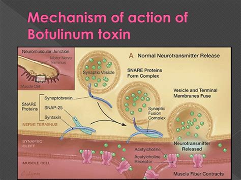 PPT - Cosmetic Uses Of Botox PowerPoint Presentation, free download - ID:1422961