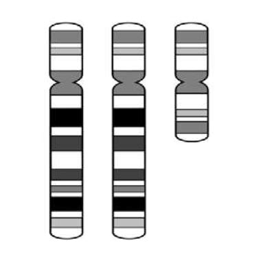 Tetrasomy 18p: Treatment and Surveillance - Chromosome 18