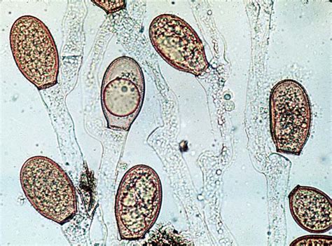 Solved This is Chytridiomycota. What part of the life cycle | Chegg.com