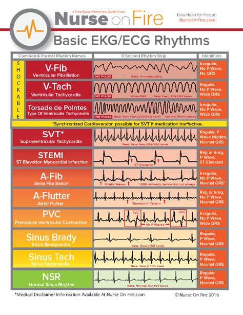 Basic EKG ECG Rhythms Cheatsheet - Copy - Basic EKG/ECG Rhythms V-Fib V-Tach Torsade de Pointes ...