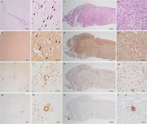 Histology and immunohistochemical staining of brain and olfactory... | Download Scientific Diagram