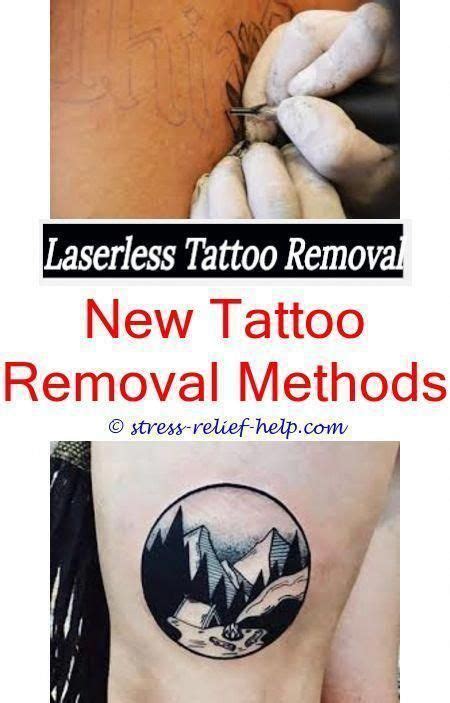 Diy tattoo removal methods.Salabrasion tattoo removal before and after.How much is laser tattoo ...