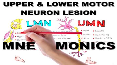 Upper & Lower Motor Neuron Lesions / Mnemonic series #5 - YouTube