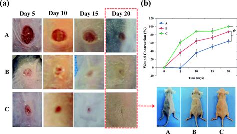 AgNP and rhEGF-incorporating synergistic polyurethane foam as a ...