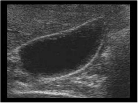 Abdomen and retroperitoneum | 1.2 Gallbladder and bile ducts : Case 1.2 ...